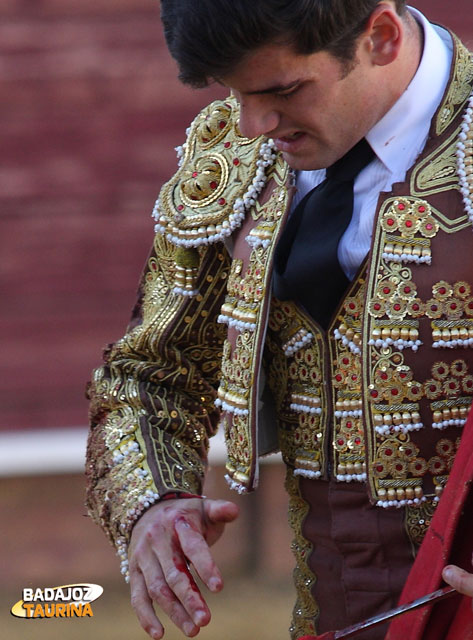 Garrido mirándose el corte del dedo índice