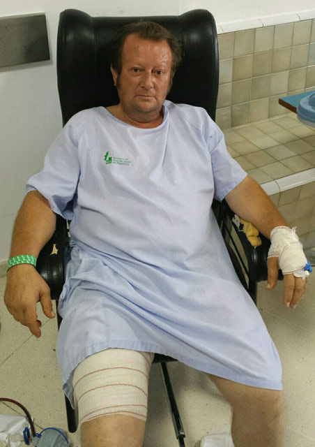 José Antonio Escobar en el hospital de Zafra recuperándose de la cornada sufrida el pasado martes en Plasencia. (FOTO: Gallardo)