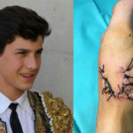 Ismael Jiménez y el estado en que quedó su mano izquierda tras ser curada en la UVI Móvil